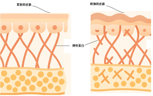 超分子弹性蛋白：肌肤弹性的“隐形守护者”